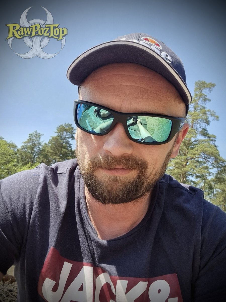 RAW ☣️ TOP tweet media