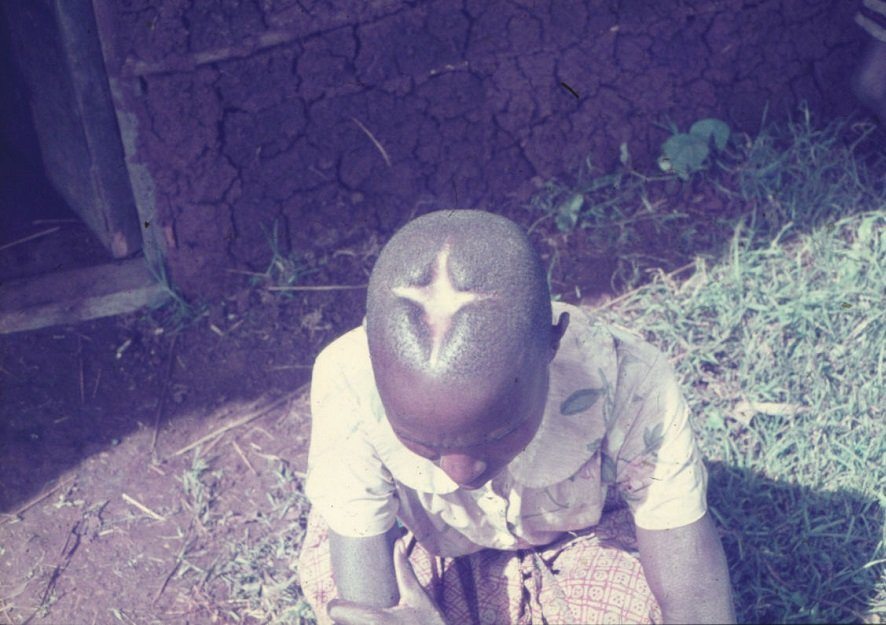 shobanes's tweet photo. The Kisii Community in Kenya used to perform traditional head surgeries (craniotomies). The traditional healer known as Omobari Umutwe or ababari emetwe. The surgeries would last around 45 minutes and would be carried out under a tree (outside) and is said to still be alive. https://t.co/1YL9wzJdH3