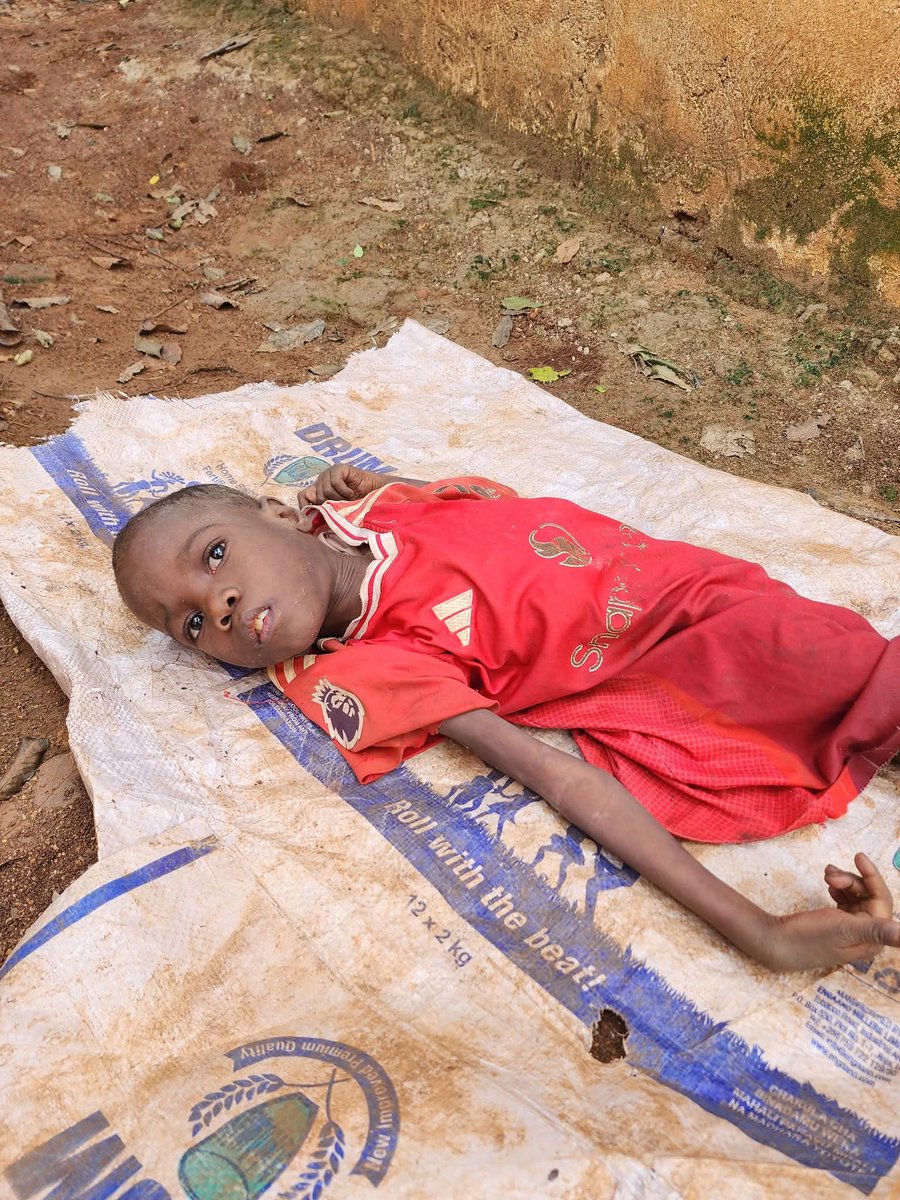 في السودان.. الجوع ينهش الأجساد، والنسيان ينهش الأمل.
أوقفوا هذه المأساة، السودان يستغيث.
#السودان_المنسي #KeepEyesOnSudan