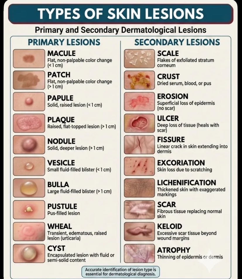 NurseHann100's tweet image. TYPES OF SKIN LESIONS

#Nursing
#NursingNotes
#Nclex
#PNLE
#MedTwt
#NursingTwt