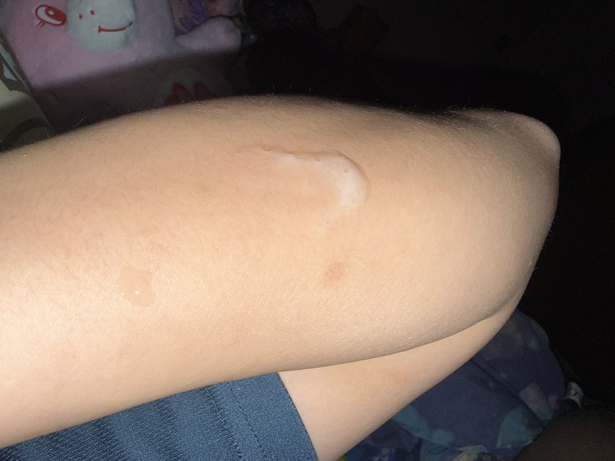 JEREMY😪 tweet media