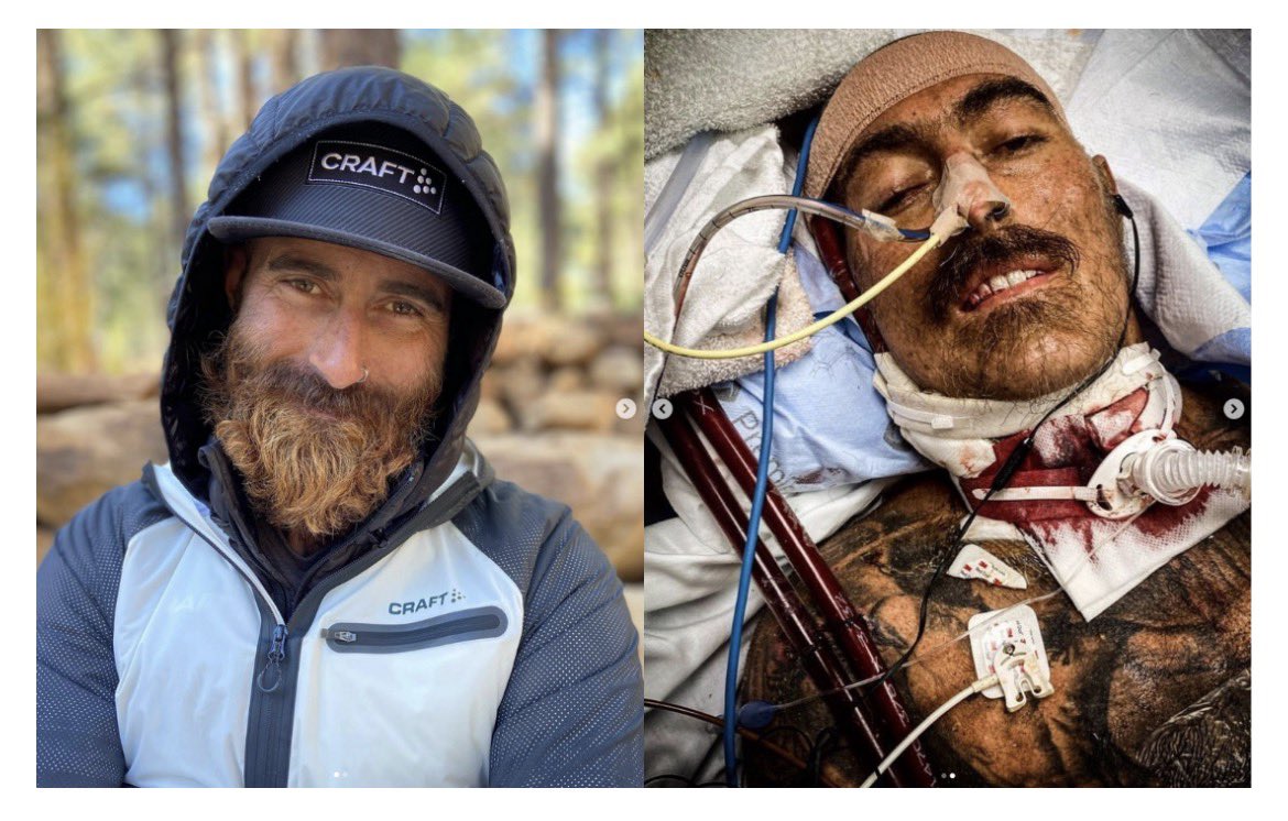 Most people outside the running world have never heard of Tommy Rivers Puzey, and honestly, that’s part of the point.

Because his story completely changes how you think about achievement.

Before illness, Rivs wasn’t just a good runner. He was elite. A 2:18 marathoner who