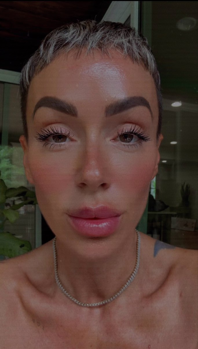 The Belgium Fox tweet media