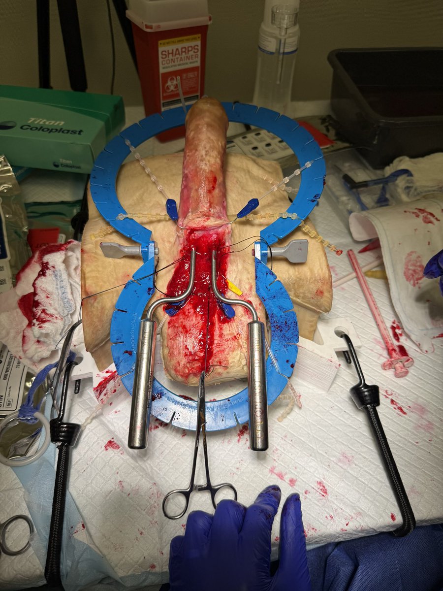 Ahmed Ghazi tweet media