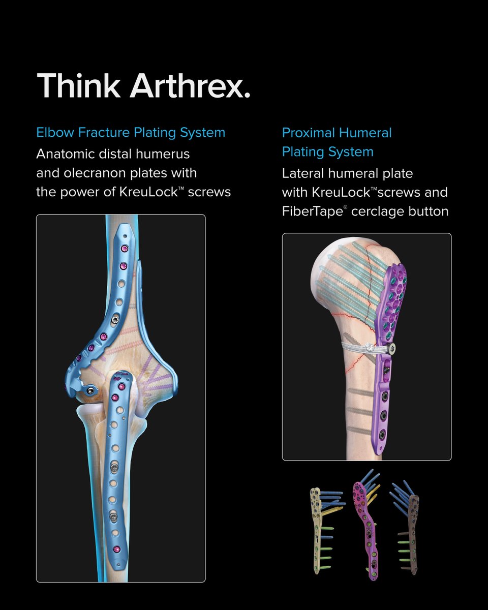 ArthrexMedEd's tweet photo. When you treat fractures, think Arthrex. Visit us at Exhibit 2239 Hall D during the #AAOS2026 Annual Meeting in New Orleans, LA to learn about our latest trauma innovations.

Swipe to view key fracture management products.

Learn more: https://t.co/U8GEV49skC

#AAOS #AAOS2026 #Arthrex #ArthrexTrauma