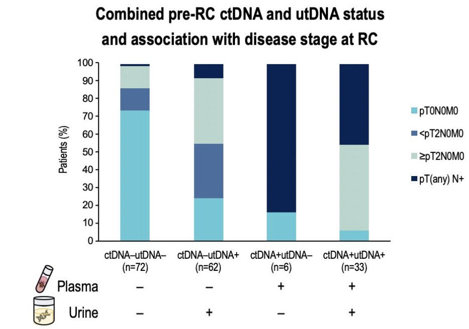 urotoday's tweet image. Urinary tumor DNA and ctDNA in patients with #MIBC who received perioperative durvalumab in #NIAGARA. Presented by @MichvdHeijden @NKI_nl. #GU26 written coverage by @zklaassen_md @GACancerCenter &amp;gt; bit.ly/40CA1TY