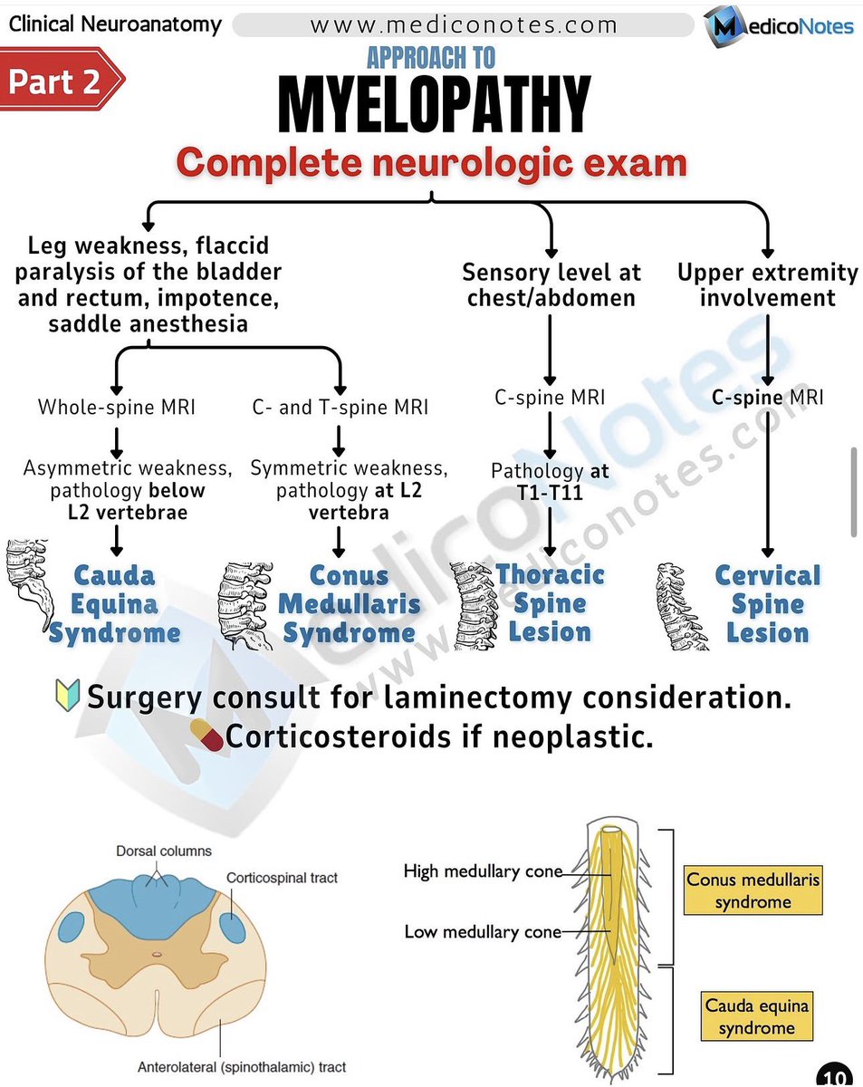MedicoNotes's tweet photo. 🧠 Approach to Myelopathy

⸻

1️⃣ Leg Weakness, Flaccid Paralysis of the Bladder and Rectum, Impotence, Saddle Anesthesia: 

•If asymmetric weakness and pathology below L2 → Cauda Equina Syndrome
•If symmetric weakness and pathology at L2 → Conus Medullaris Syndrome

➊ Cauda Equina Syndrome
•Caused by compression of multiple lumbosacral nerve roots.
•Key features: Asymmetric leg weakness, severe radicular pain, saddle anesthesia, areflexia, late bladder/bowel involvement.
•Common causes: Disc herniation, tumors, trauma, epidural abscess/hematoma.

➋ Conus Medullaris Syndrome
•Lesion at the terminal spinal cord (around L1-L2).
•Key features: Symmetric lower limb weakness, early bladder/bowel dysfunction, perianal anesthesia, preserved knee reflexes, absent ankle reflexes.
•Causes: Tumors, trauma, ischemia, syringomyelia.

⸻

2️⃣ Sensory Level at Chest/Abdomen
•Likely Involvement: Thoracic spinal cord (T1–T11).
•Investigation: C-spine MRI (to rule out cervicothoracic lesions)
•Diagnosis: Thoracic Spine Lesion

➊ Thoracic Myelopathy
•Often due to compressive lesions (e.g., disc herniation, tumors), multiple sclerosis, or vascular malformations.
•Symptoms include spastic paraparesis, sensory level, and sphincter dysfunction.

⸻

3️⃣ Upper Extremity Involvement
•Likely Involvement: Cervical spinal cord
•Investigation: C-spine MRI
•Diagnosis: Cervical Spine Lesion

➊ Cervical Myelopathy
•Common causes: Cervical spondylotic myelopathy, trauma, tumors.
•Symptoms: Upper limb weakness, gait disturbance, hand clumsiness, Lhermitte’s sign, and hyperreflexia.

⸻

🔗Visit our website to get the new high-yield neurology book:
https://t.co/2UQyCbb6in

⸻

#MedEd #MedicalEducation #DoctorsOfInstagram #MedicalStudents #Medicine