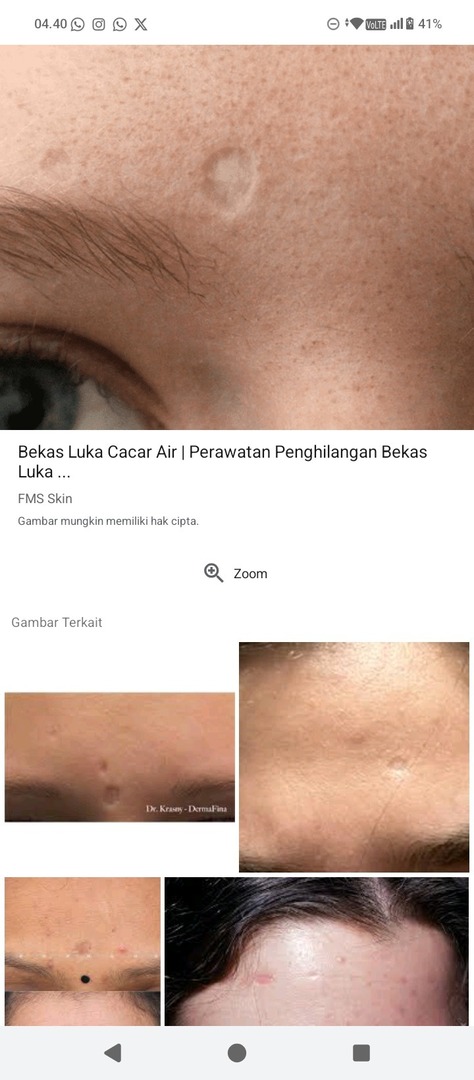 ✨OMBB | 🚫NO LINK tweet media