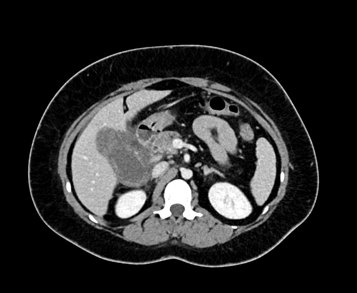 Dr.ALHARTHI Mohammed tweet media