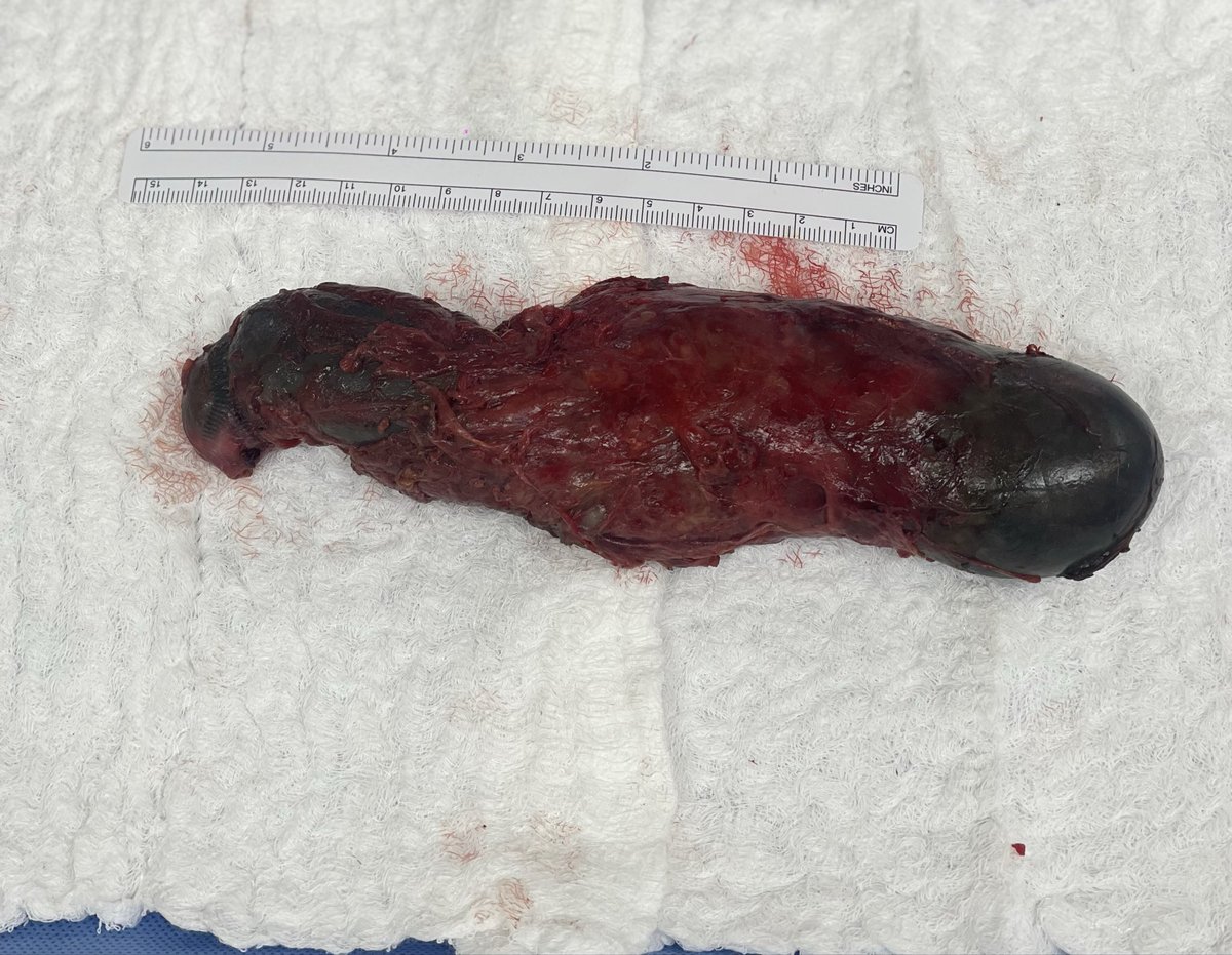 Dr.ALHARTHI Mohammed tweet media