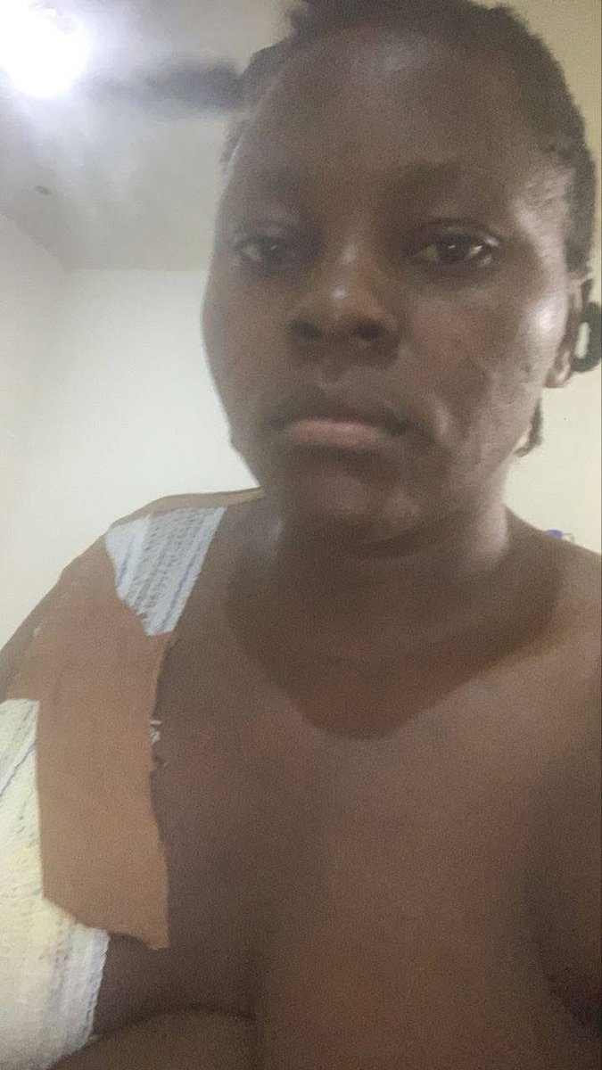 💔 PLEASE HELP ME SAVE MY WIFE, EDITH 🙏

My wife, Edith Igoru Captain, has been diagnosed with breast cancer. Doctors say she needs a mastectomy and urgent chemotherapy.

As her husband, I’m doing everything I can, but the cost of treatment is more than I can handle alone.