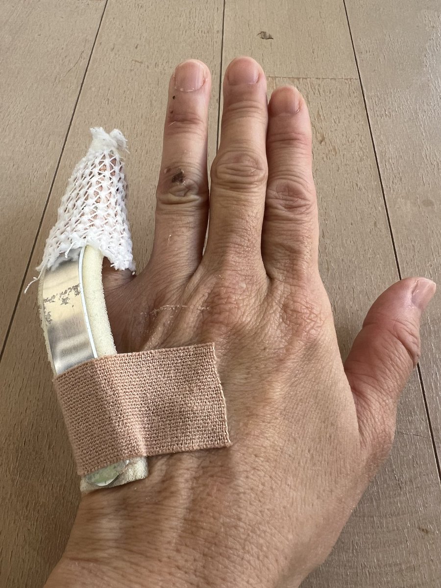 左手小指骨折してから二週間🦴
あれから毎週、整形外科に通ってレントゲン🩻撮ってますがね、まだくっついてないです
当たり前か😅