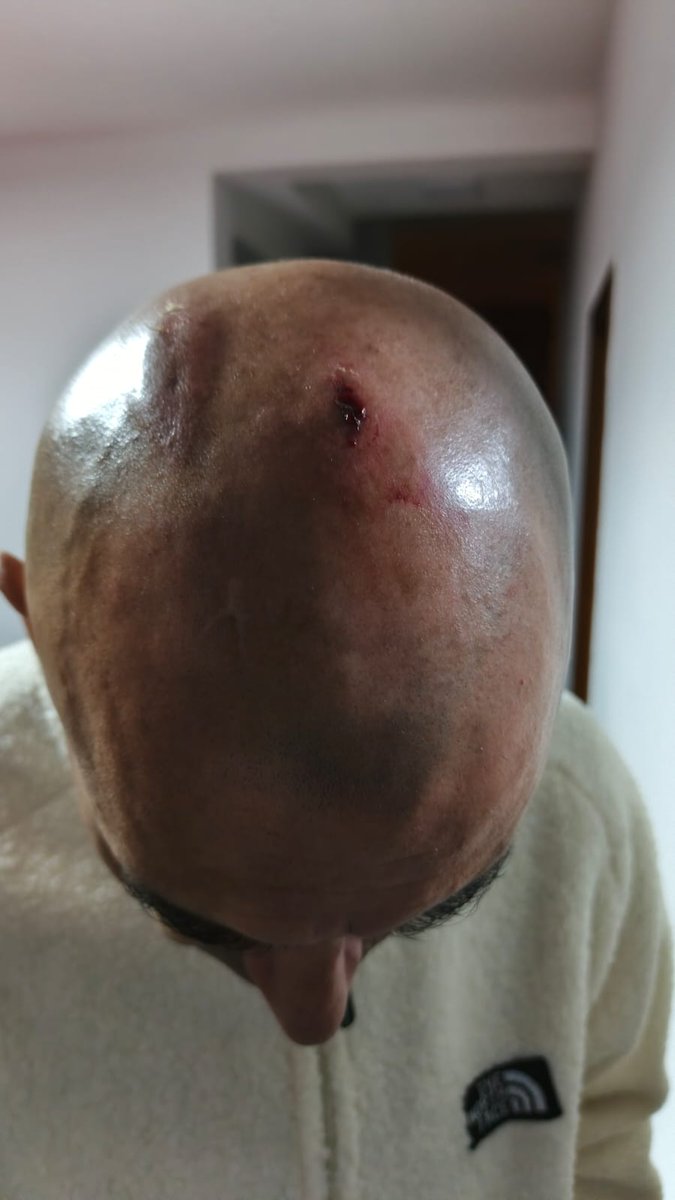 ElenaDeQuito's tweet photo. URGENTE: Denuncian ataque al Centro Cultural Iraní en Quito.

Desde el Centro Cultural Iraní, en Quito, se reporta un ataque perpetrado por grupos identificados como sionistas y ciudadanos que portan banderas de Estados Unidos. Según las denuncias, hay personas heridas y se encuentran niños y mujeres atrapados dentro del recinto, dónde además se lanzó gas lacrimógeno. En los exteriores, los autos han sido atacados. Testigos alertan que la Policía Nacional no ha respondido a los llamados de auxilio.