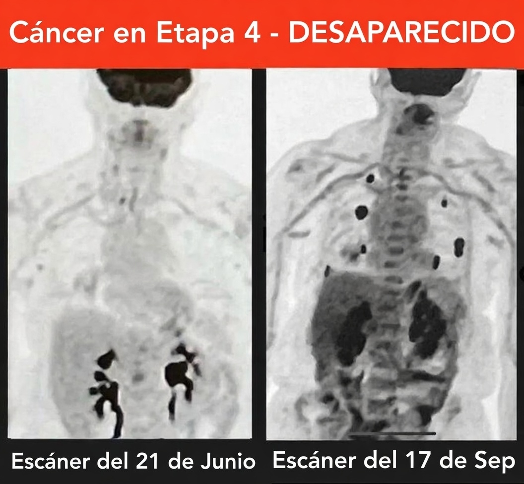 Kaizen Mindset 🌱 tweet media