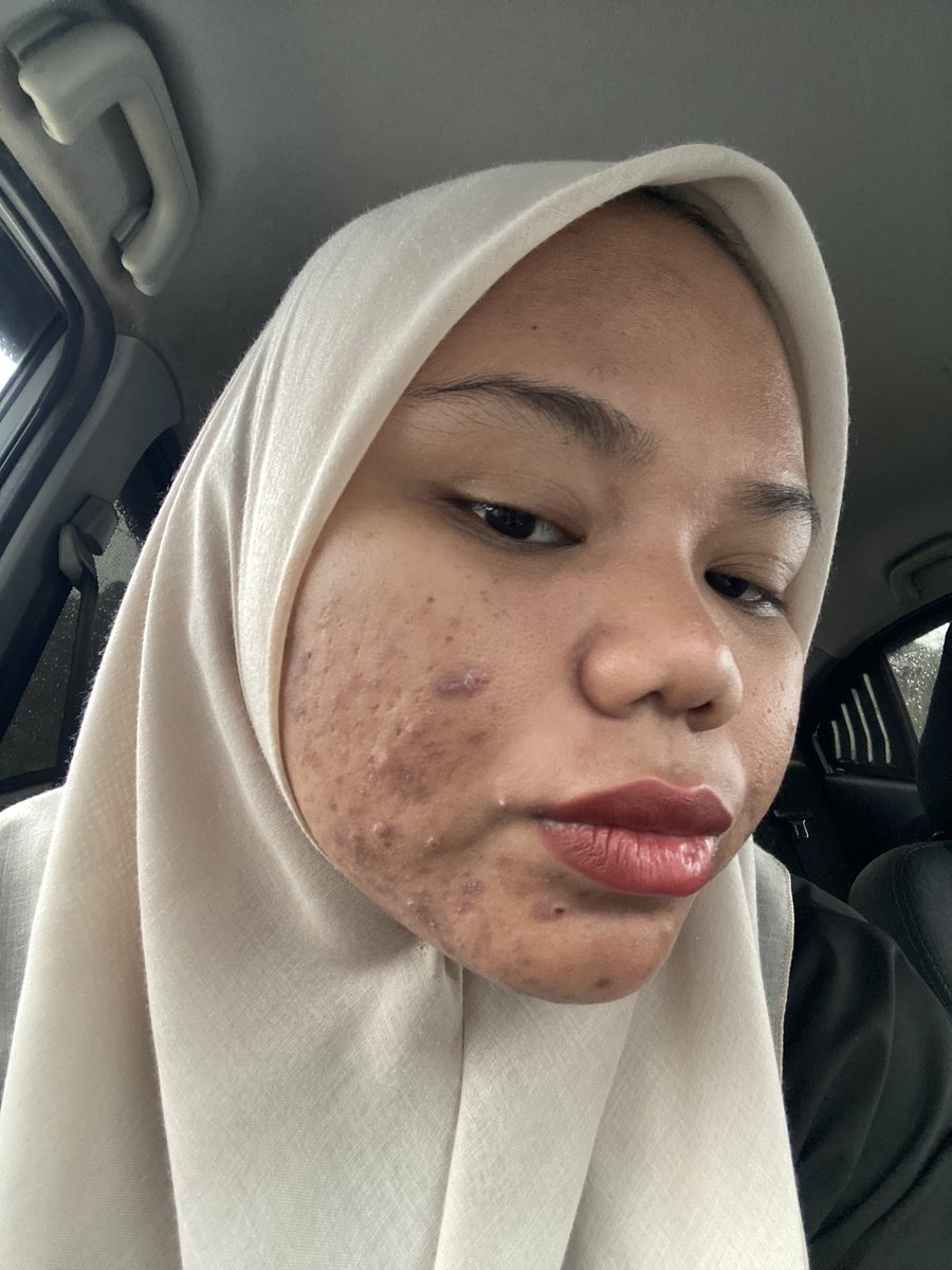 suhanisnasri's tweet photo. lepastu cakap aku ni menjual je tak consume pun. jahat mulut tau. aku consume la. tapi ada masa hormon tak betul, akan naik juga sebab aku ambik depo. tapi lepastu okay je dia recovery balik. https://t.co/s4wImmP42t