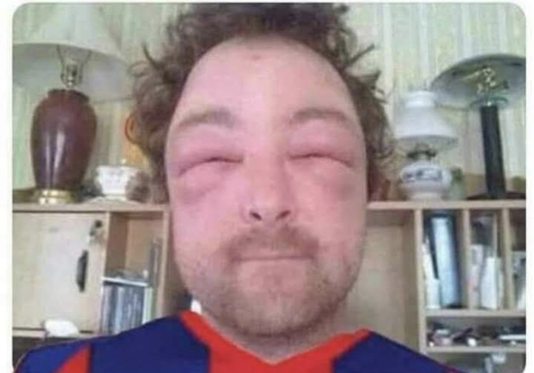 Personalmente me chupa un huevo verdad pero es notable el robo en CDE che.

No sé puede jugar así Cerro debe retirarse de la competición ya mismo.

La apf ya tiene a su campeón