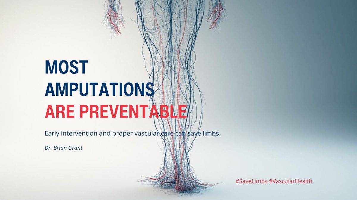 briangrantmd's tweet photo. Most amputations are preventable.
Early vascular diagnosis and treatment can save limbs — and lives. Don’t ignore leg pain or non-healing wounds.
#LimbSalvage #PAD #VascularSurgery #BowlingGreenKY #vascular https://t.co/ThQhJRuHXj