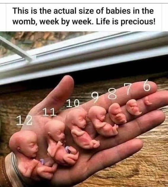 Stop Abortion Now (@lifenewstoo) on Twitter photo 