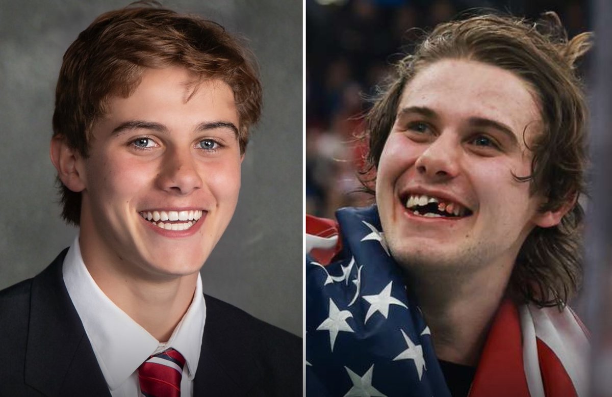 MrsDanielleGill's tweet photo. Team USA Olympic star Jack Hughes’s high school portrait has gone viral showing his perfect teeth.
Jack sacrificed his own teeth in order to win for the United States.
God bless him!
Follow: @DanielleDSouzaG https://t.co/EVOvk3Vixl