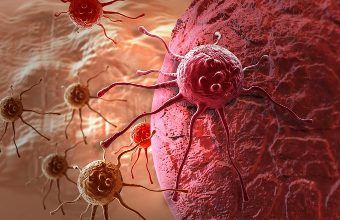 astronomiaum's tweet photo. 🚨ATENÇÃO: Cientistas criaram bactérias que se infiltram em tumores cancerígenos e os devoram de dentro para fora.

Pesquisadores da Faculdade de Engenharia de Waterloo desenvolveram bactérias geneticamente modificadas para consumir tumores cancerígenos de dentro para fora, numa nova e promissora abordagem de tratamento.

A equipe de pesquisa interdisciplinar encontrou duas soluções fundamentais para usar uma bactéria chamada Clostridium sporogenes, comumente encontrada no solo e que só consegue crescer em ambientes sem absolutamente nenhum oxigênio, para consumir o câncer de forma eficaz.

O núcleo de um tumor sólido e canceroso é composto de células mortas e é desprovido de oxigênio, tornando-se um ambiente ideal para a multiplicação da bactéria.

“Os esporos de bactérias entram no tumor, encontrando um ambiente com muitos nutrientes e sem oxigênio, que é o que esse organismo prefere, e então ele começa a consumir esses nutrientes e a crescer”, disse  o Dr. Marc Aucoin , professor de engenharia química.

“Então, agora estamos colonizando esse espaço central, e a bactéria está essencialmente livrando o corpo do tumor.”

O promissor projeto surgiu do trabalho do estudante de doutorado Bahram Zargar, que foi supervisionado pelo Dr. Brian Ingalls, professor de matemática aplicada em Waterloo, e pelo Dr. Pu Chen, professor aposentado de engenharia química.