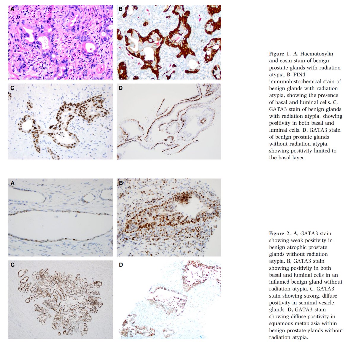 Ting Zhao, MD tweet media