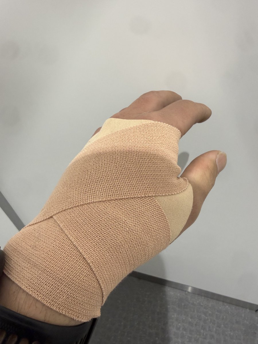 無事終われませんでした😂
転んだ時、手の甲にハンドガードヒットして折れたと思ったけどもしかしたら平気かも？