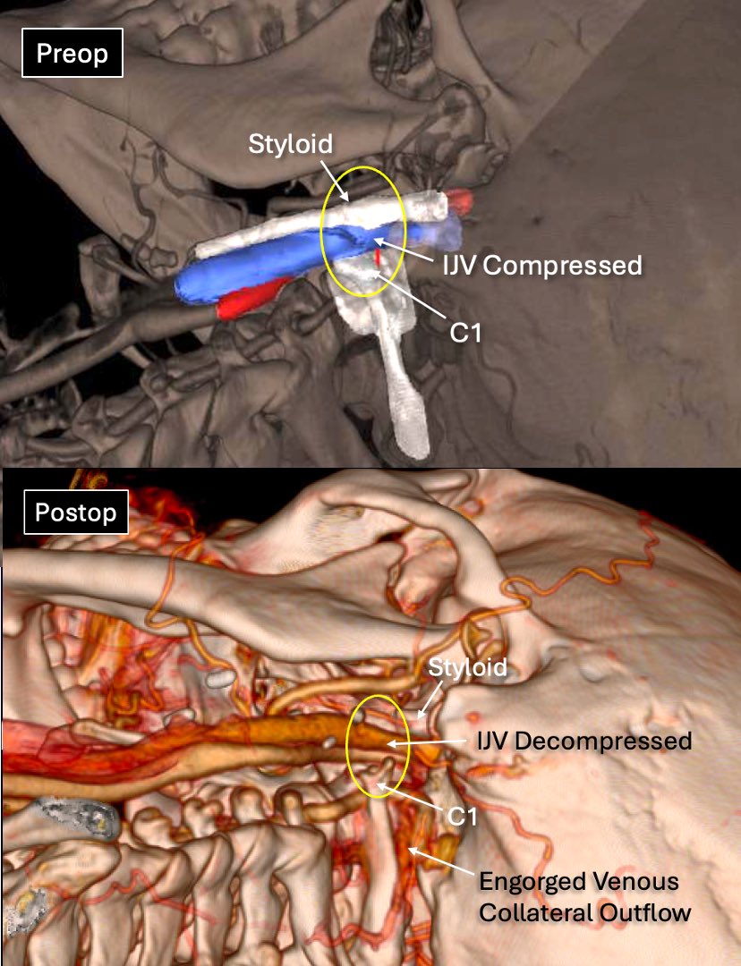 James K. Liu, MD tweet media