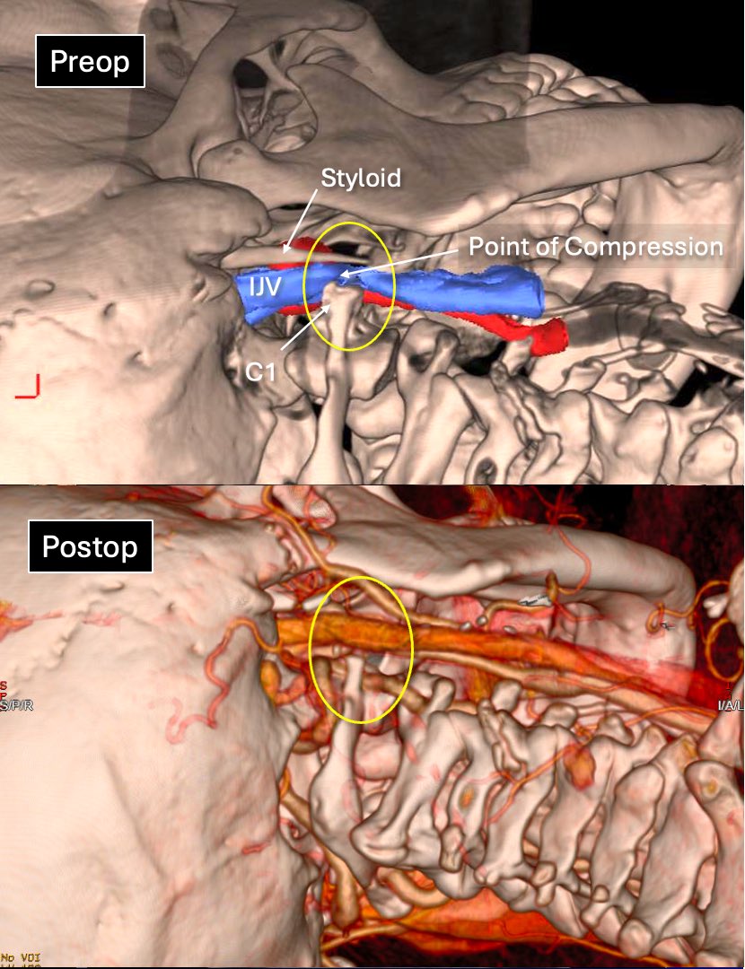 James K. Liu, MD tweet media