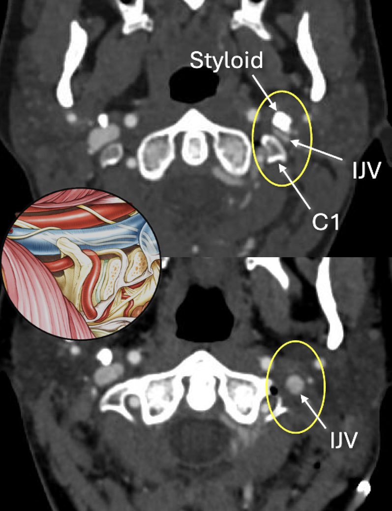 James K. Liu, MD tweet media