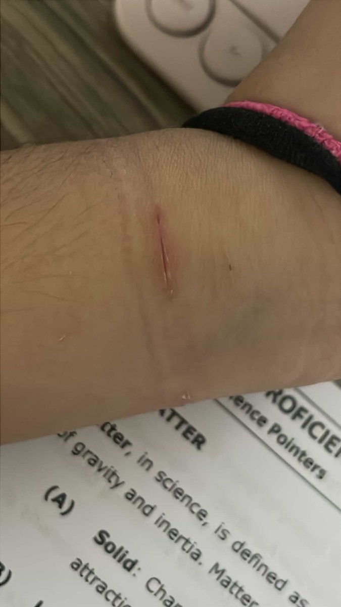 yumeoverload's tweet photo. brah my doctor (yuo) isnt replying and im #abit worried cause why do it look like this... #help https://t.co/K7rHSkeip4