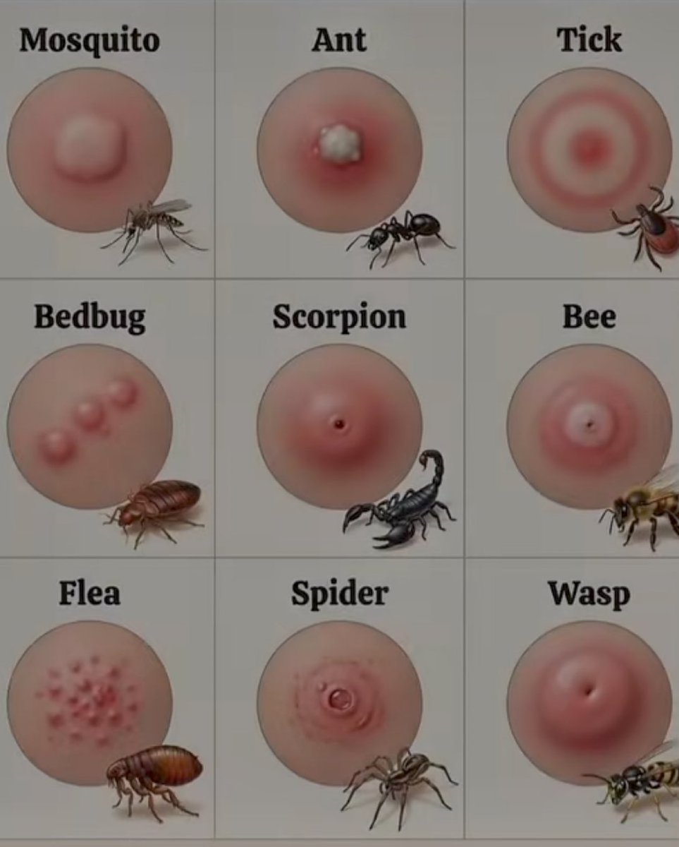 This is how you know what bit you...