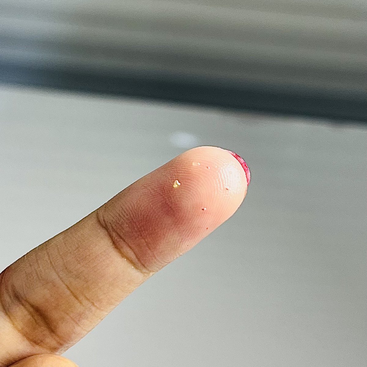 ruparipi_'s tweet photo. Me: cleansing oil mahal amat sampe ratusan ribu 

Also me: KENAPA GAK DARI DULU PAKAI CLEANSING OIL 😭😭
komedo yang bergerenjul jadi pada rontok, kerasa bersih banget mukanya 😤 https://t.co/aUEd0QJr14