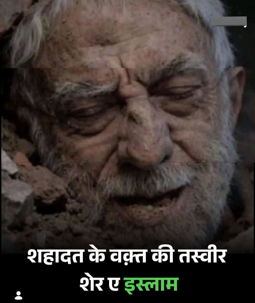 आयतुल्लाह खामेनेई ज़िंदा है शहीद कभी नहीं मरते।

#iran