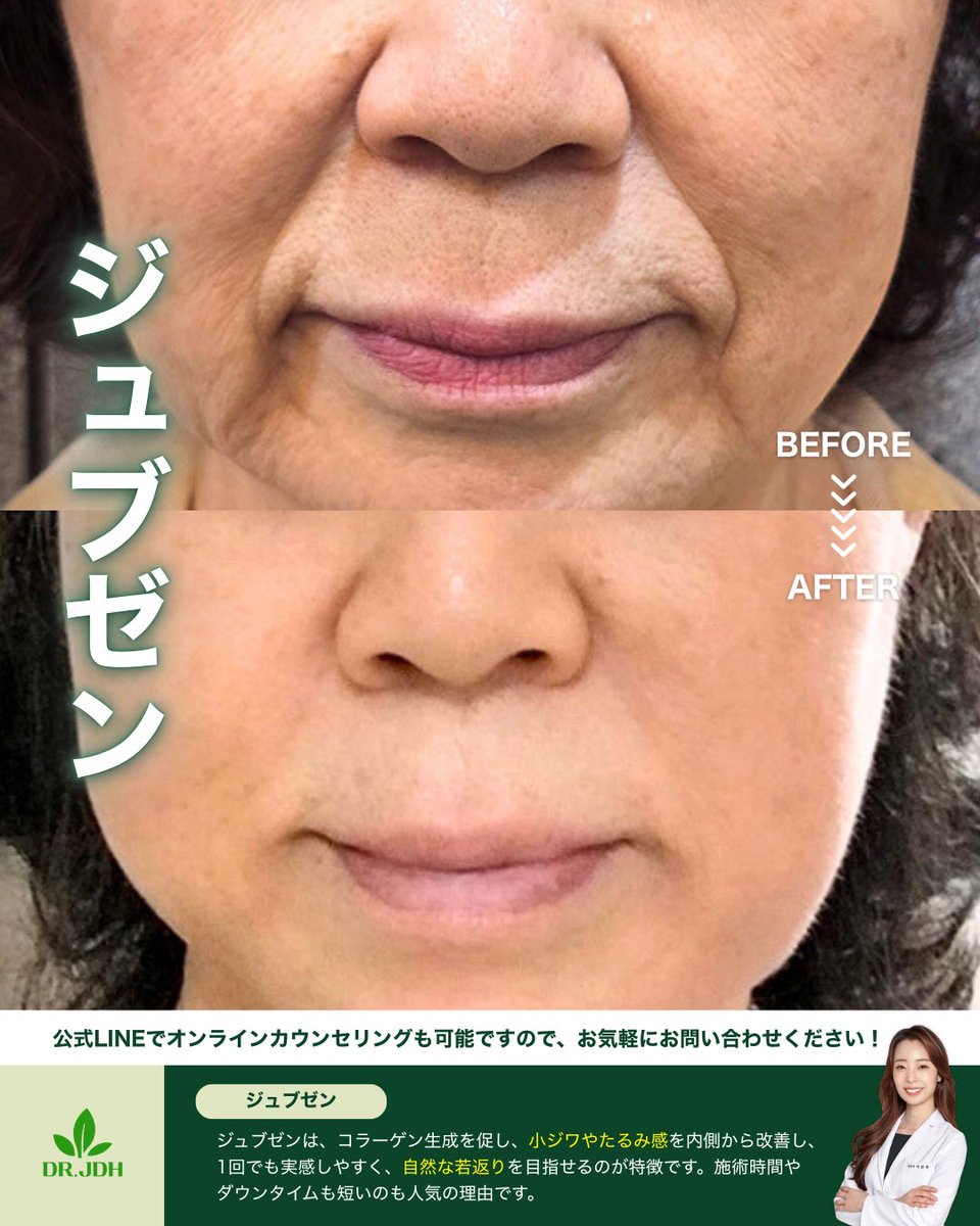 チャンドク韓方病院【アンチエイジング・肌管理】 tweet media