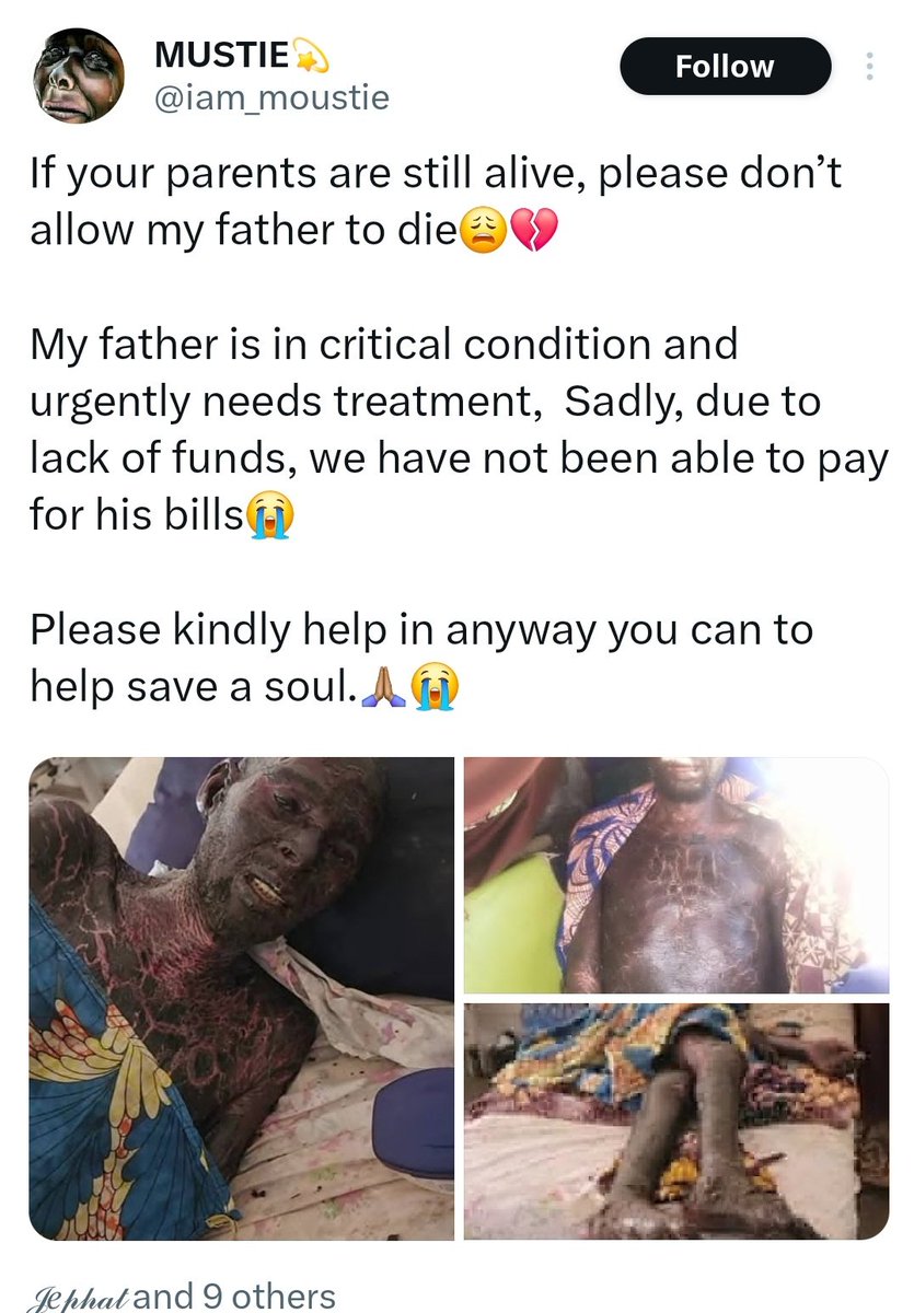 SCAMMER AND FRAUDSTER ALERT!!!
Please read &amp; share

There is an account <a href="/iam_moustie/">MUSTIE💫</a> saying his father is sick and has been collecting donations.

He is thief and fraudster. He is using a fake picture to collect money.

The account is <a href="/iam_moustie/">MUSTIE💫</a> 

Don't donate. An expose