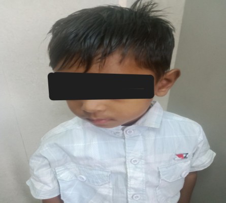 Success Story-Rare Diseases: #RareDiseaseDay2026 
AIIMS Jodhpur Center of Excellence for Rare Diseases demonstrates the dual power of National Policy for Rare Diseases, 2021 providing two benefits to a family. While their first child was diagnosed with Gaucher’s disease, received