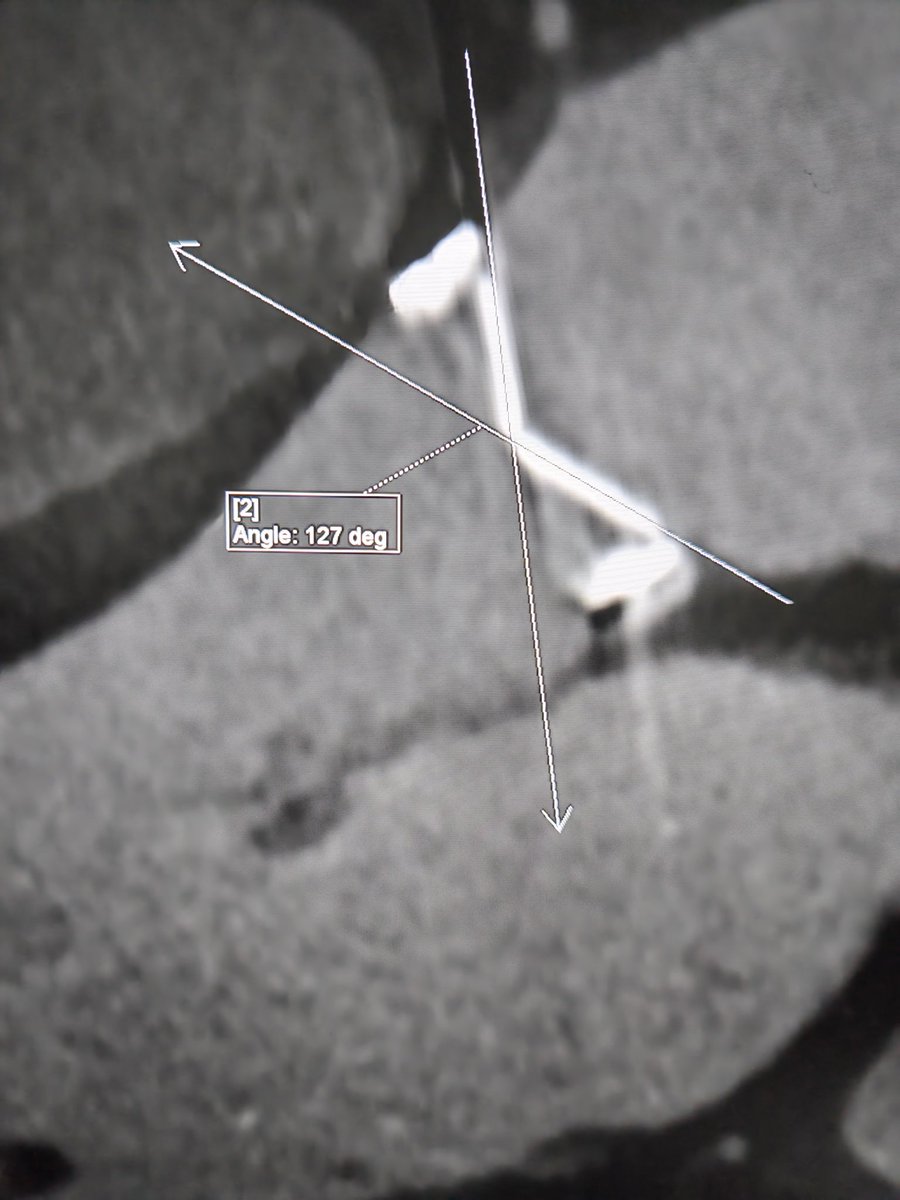 Moath Said Alfawara,MD tweet media