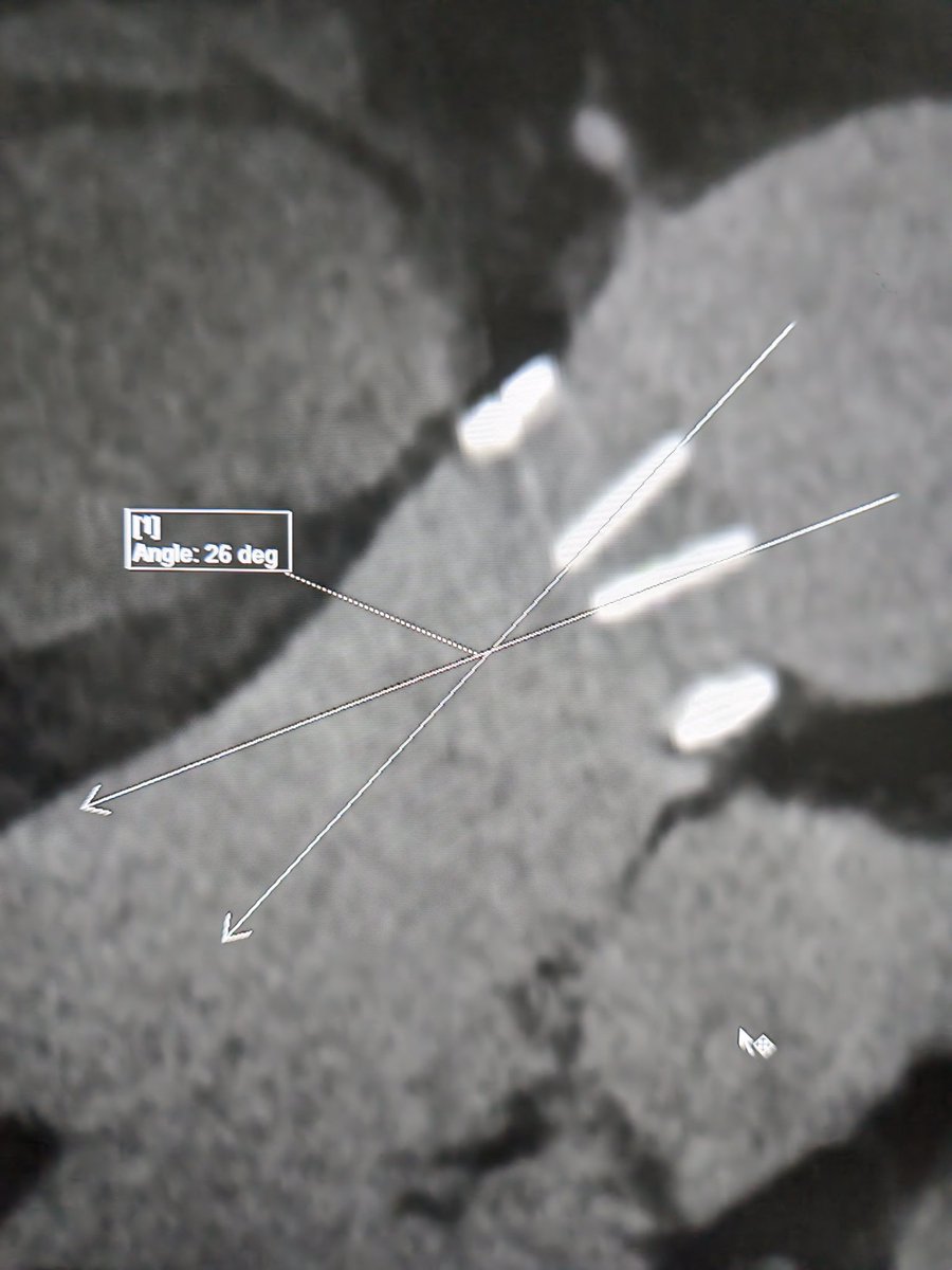 Moath Said Alfawara,MD tweet media