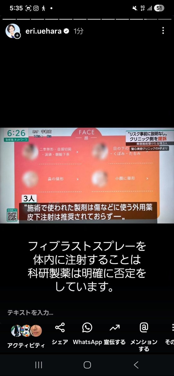 dr_uehara's tweet photo. JSAS(非形成外科系美容外科学会)理事長が経営するクリニックですのでJSASとして医の倫理に基づいた通達を是非していただきたい。
以前より、PRPにフィブラストを混注することによるトラブルは多く指摘されていましたが、集団訴訟まで至る流れになっているので、逃げずに説明責任を果たして頂きたい。 https://t.co/0SEZK1masA
