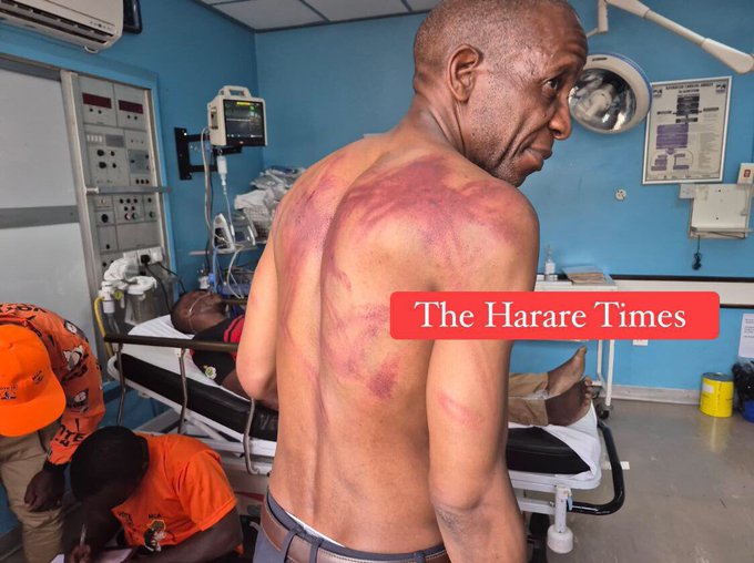 hbanhire's tweet photo. Then you hear someone say @edmnangagwa is better than Mugabe. https://t.co/ugxNctk5Pf