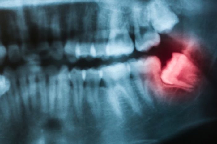 sunglasses tweet media