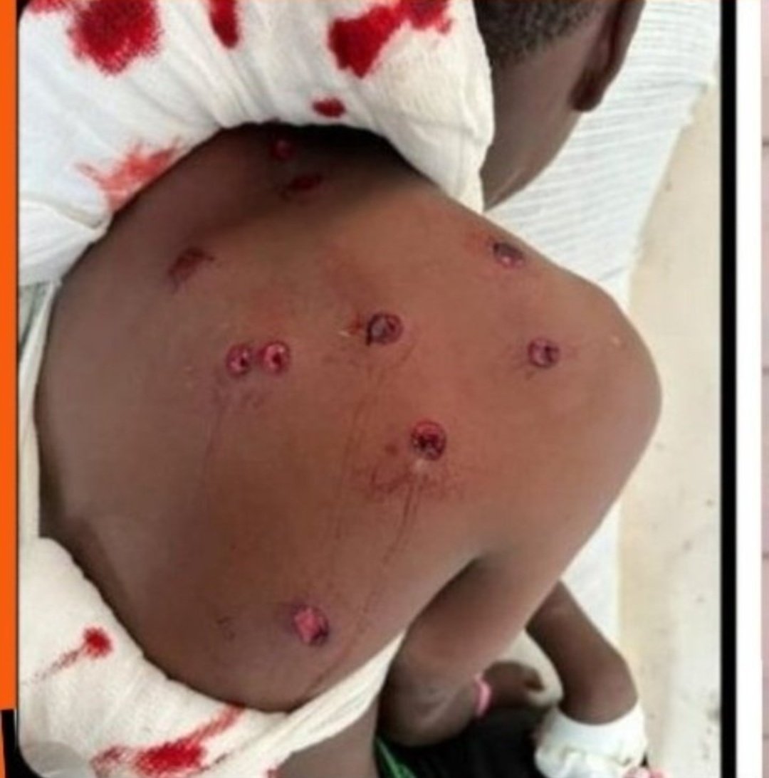 nziokamul1's tweet photo. So should anyone aggress against you, assail him in the manner he assailed you.
#RutoMustGo 
#OccupyStatehouse https://t.co/muW2rMbapz