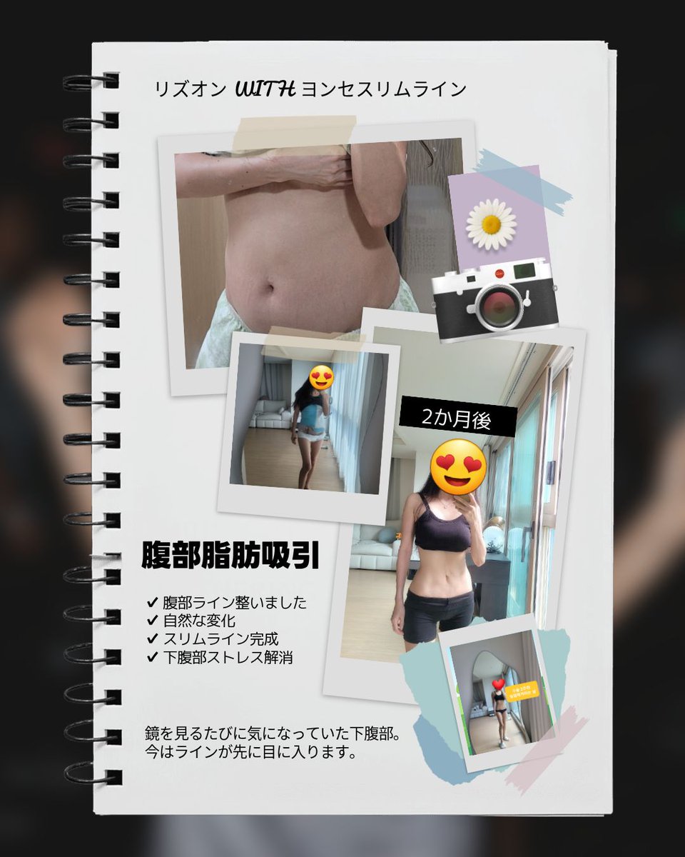 ヨンセスリムライン医院 tweet media