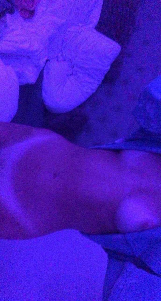 Nnbopfacegoon's tweet photo. Crazy tan lines 🥵🌶️ https://t.co/Q2lICgq1Na