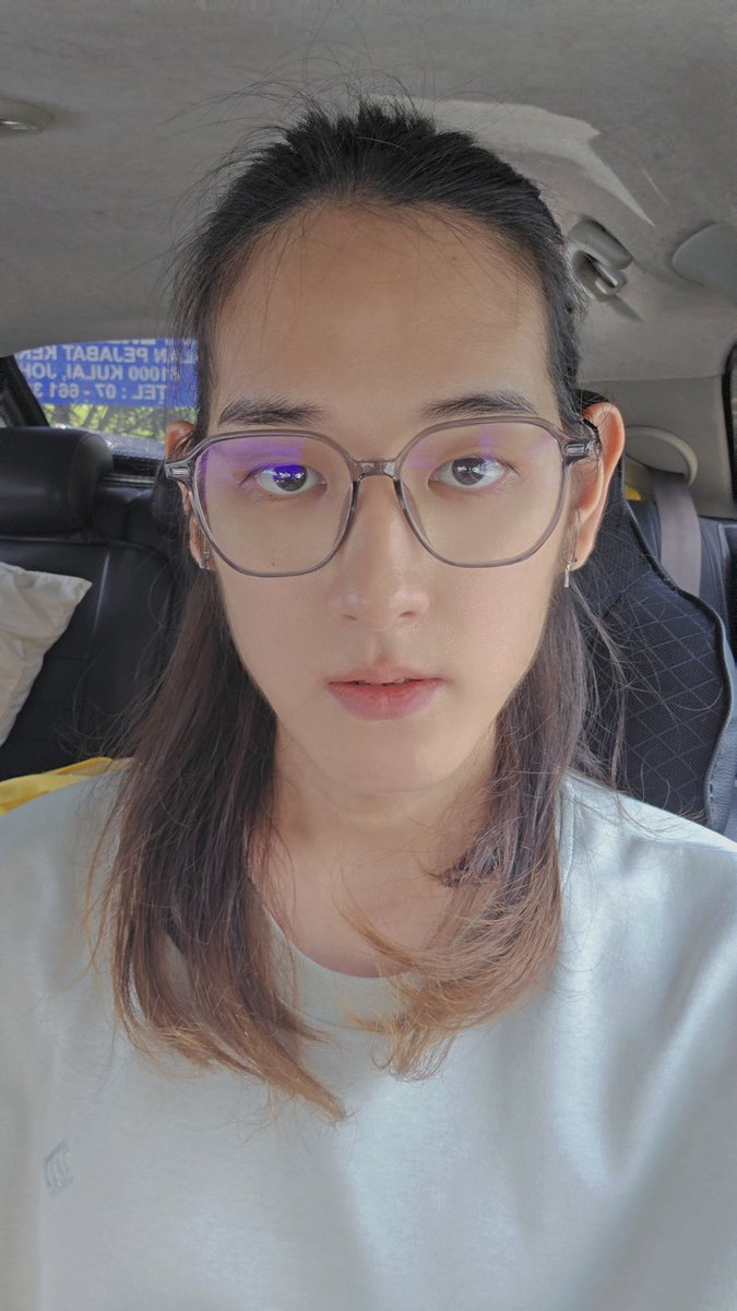 超级高额头和超级长脸😅
不是发线后移而是本来就如此🤣
