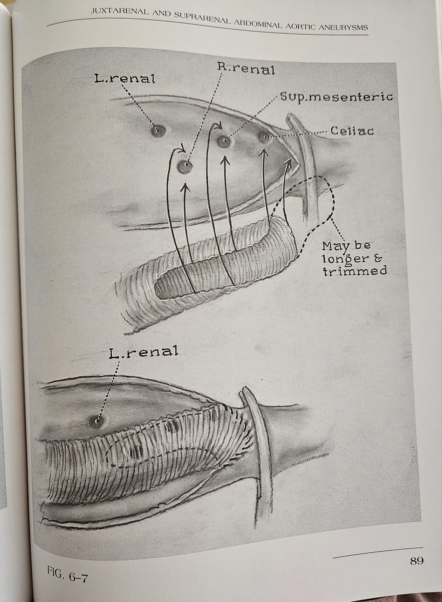 PrajnaKota's tweet image. I was hunting for this book and finally got it 🙂 What books do you prefer for aortic surgery?  #aortaed