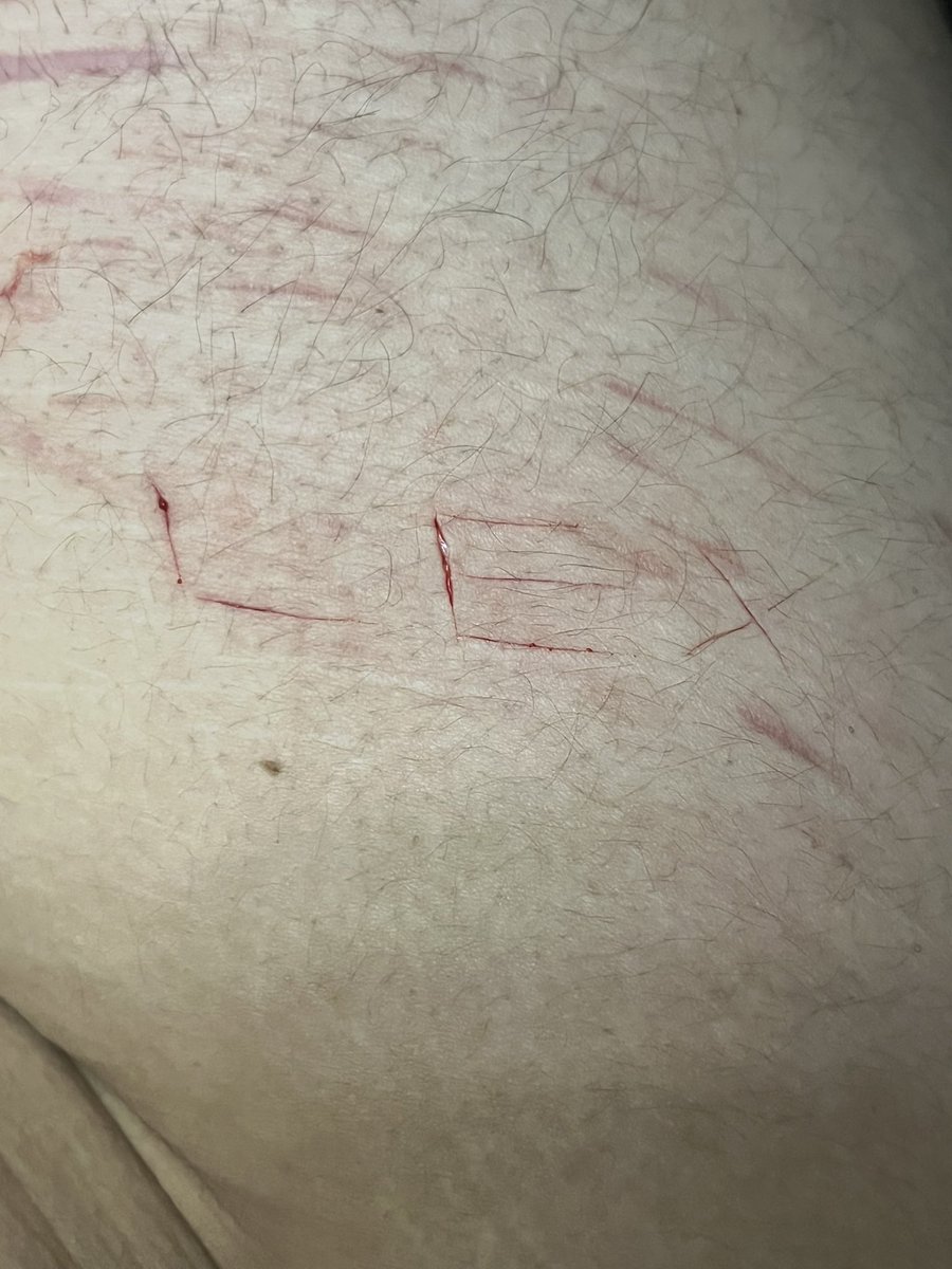 ♱ 𝑩𝑰𝑳𝑳 𝑪𝑰𝑷𝑯𝑬𝑹 𝑶𝑭 𝑺𝑯𝑬𝑫𝑻𝑾𝑻 ♱ tweet media