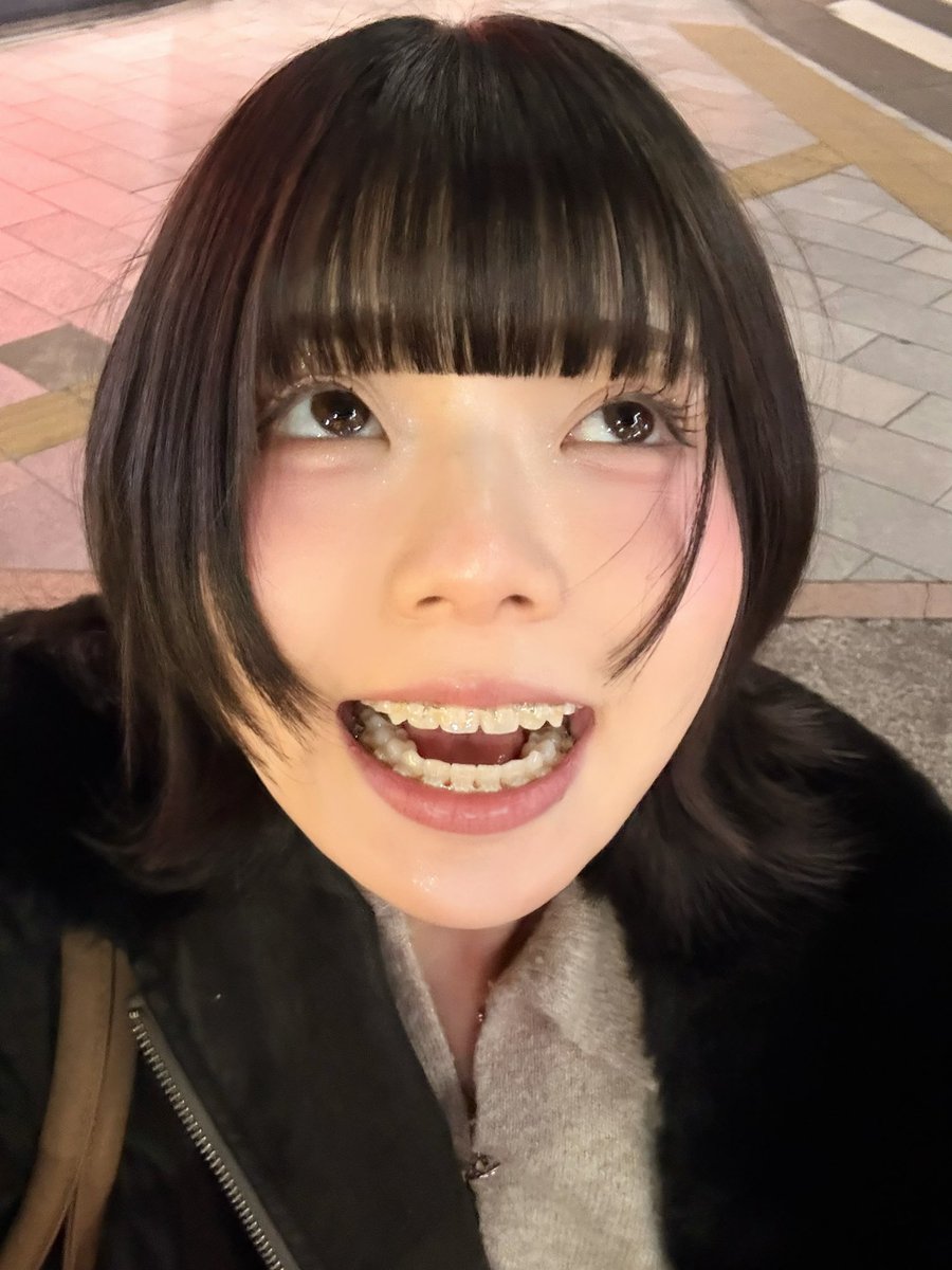 矯正明日とれます