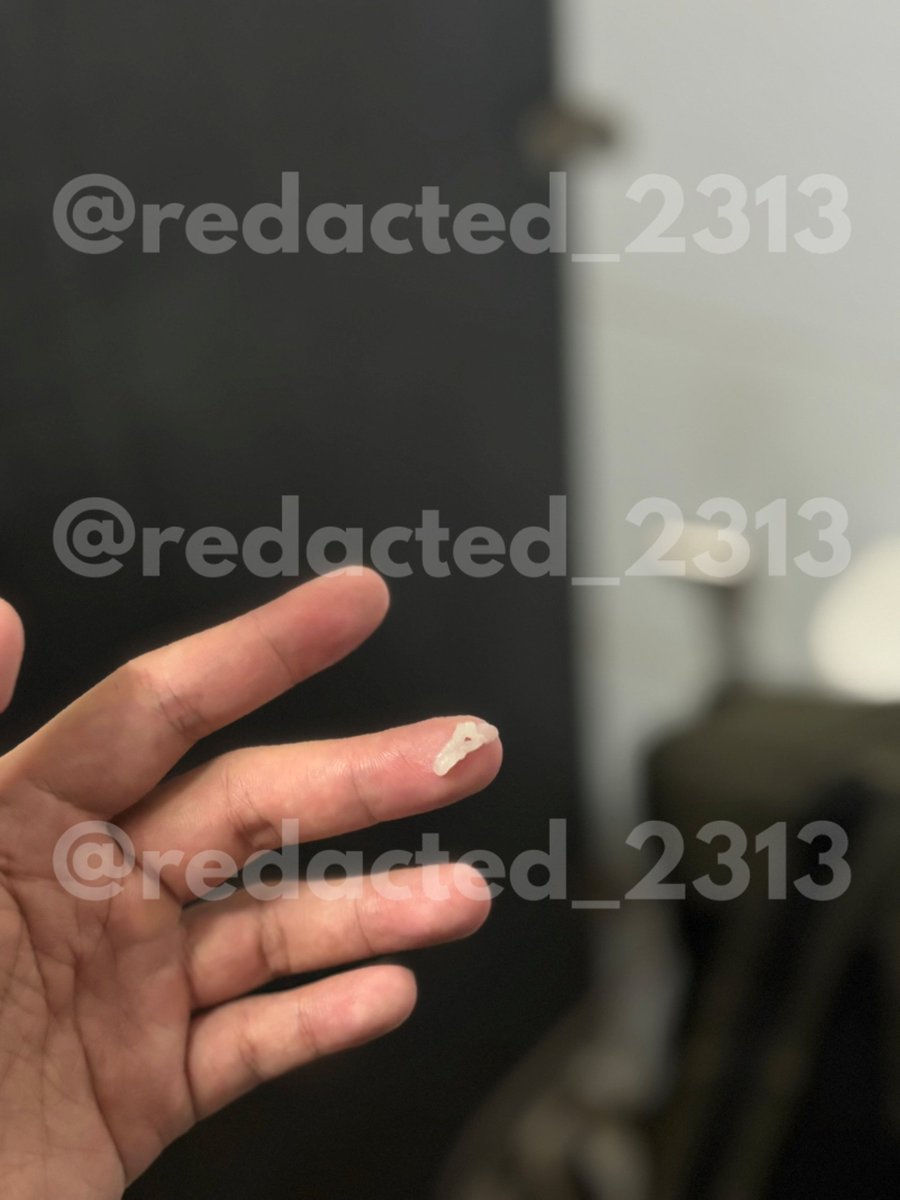 _redacted tweet media