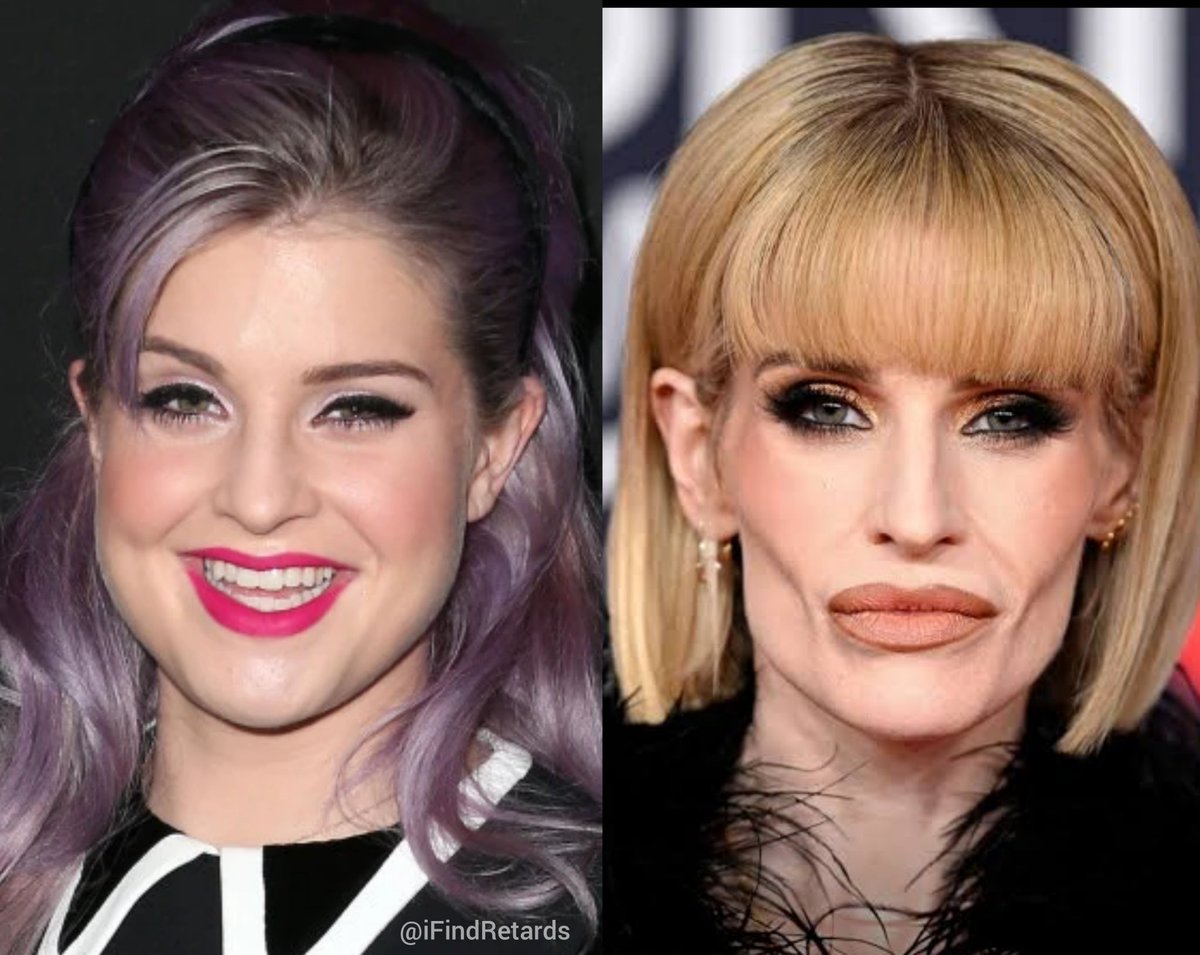 Wtf happened to Kelly Osbourne?
